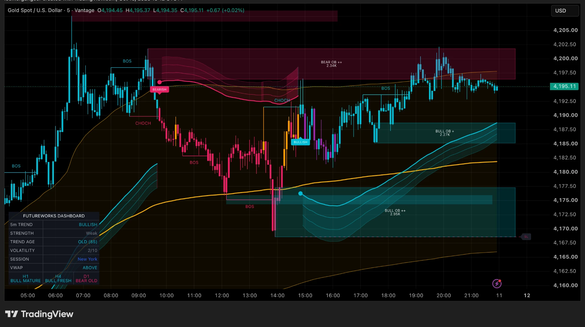 Structure Pro on a 5-minute XAUUSD TradingView chart with support and resistance zones, trend bands and VWAP